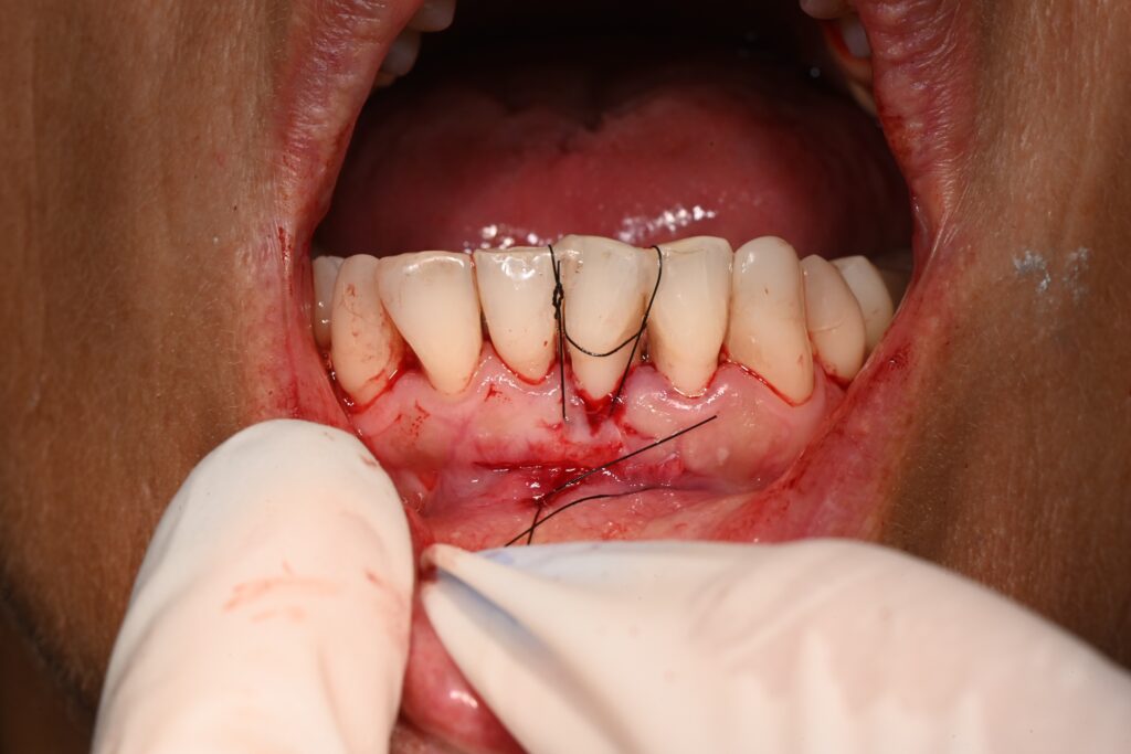 635_photo42_dsc_1868