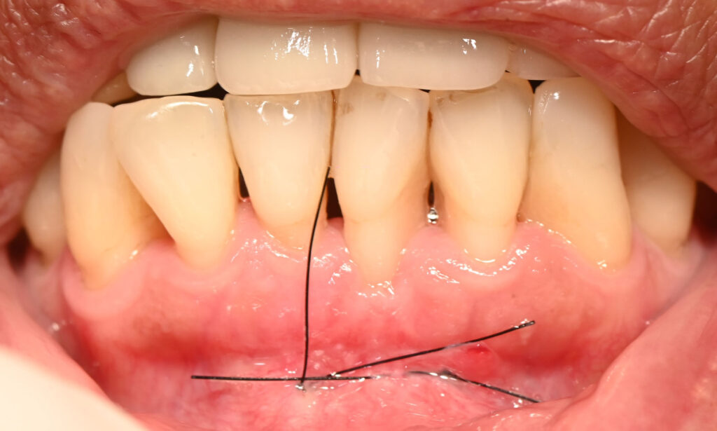 635_photo43_dsc_1896-site3