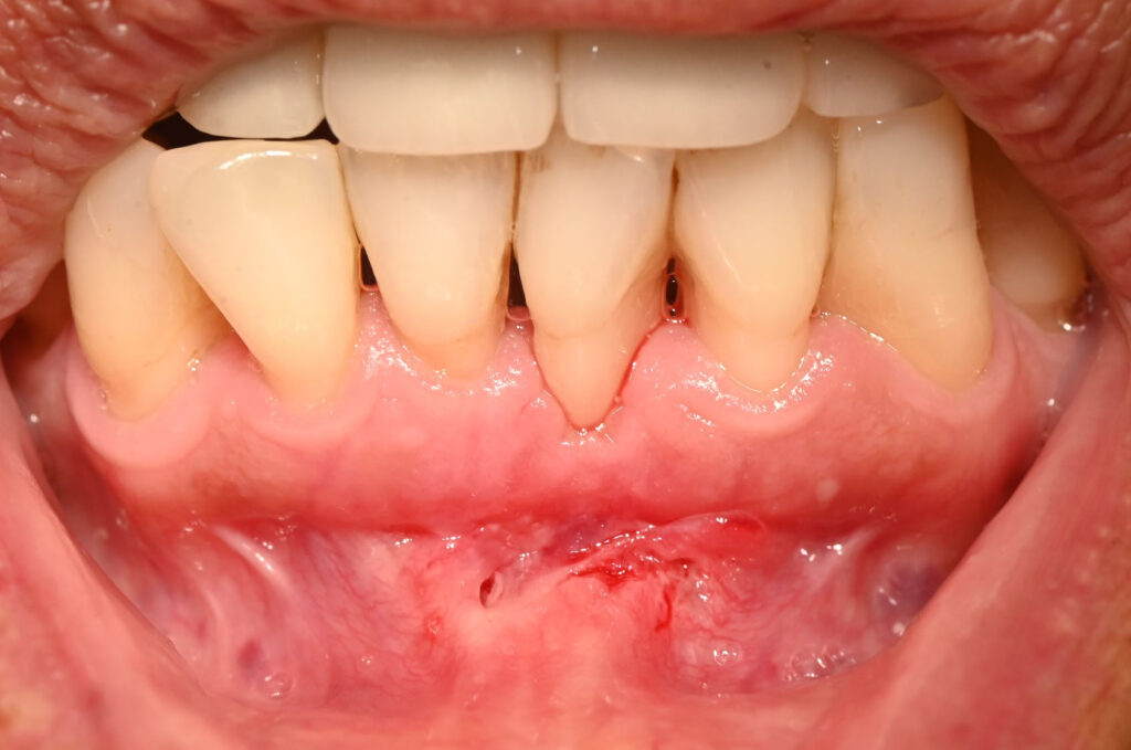 635_photo44_dsc_1897-site4